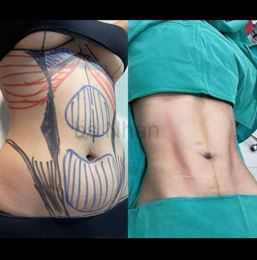 Slider image (3) Dr. Nhan Ho Aesthetics and Plastic Surgery